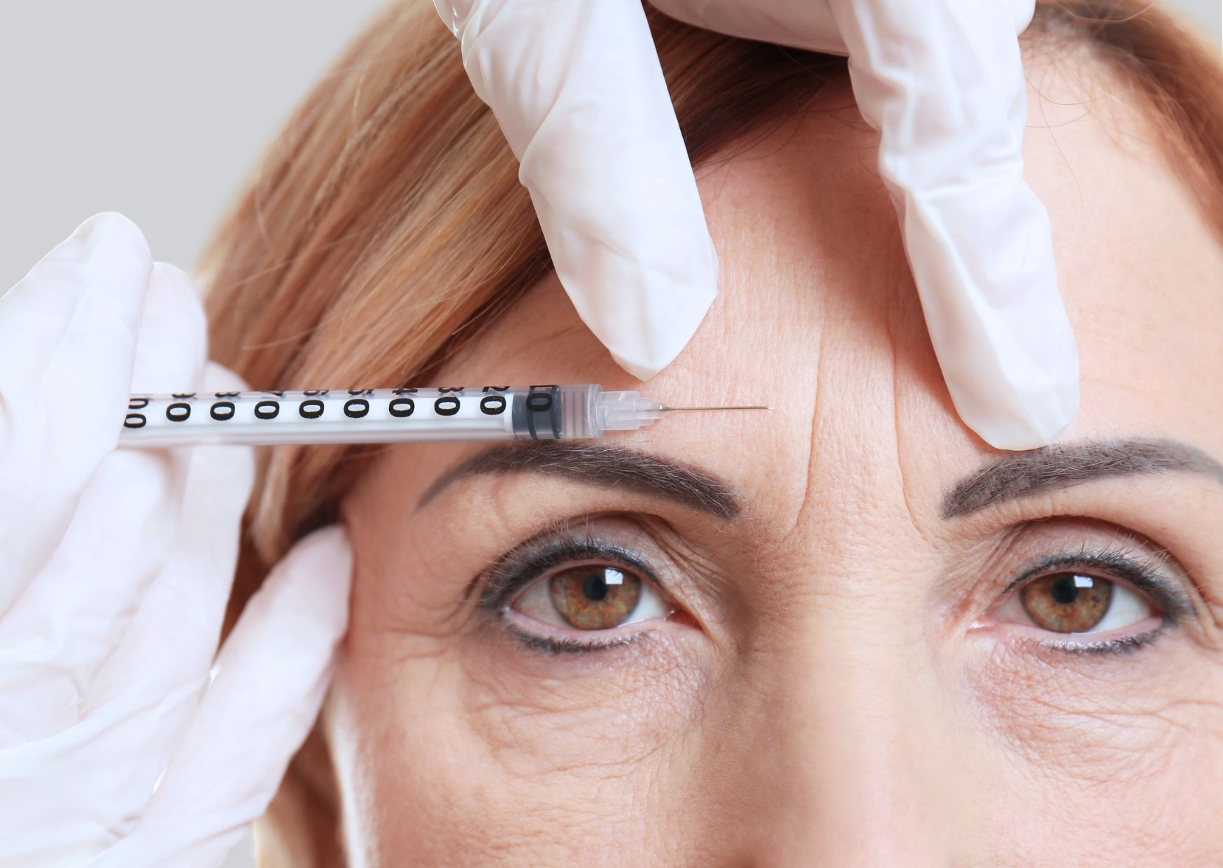 Botox Brno, odstranění vrásek, jak odstranit vrásky, plastická chirurgie, kosmetika Botox Brno, odstranění vrásek, jak odstranit vrásky, plastická chirurgie, kosmetika