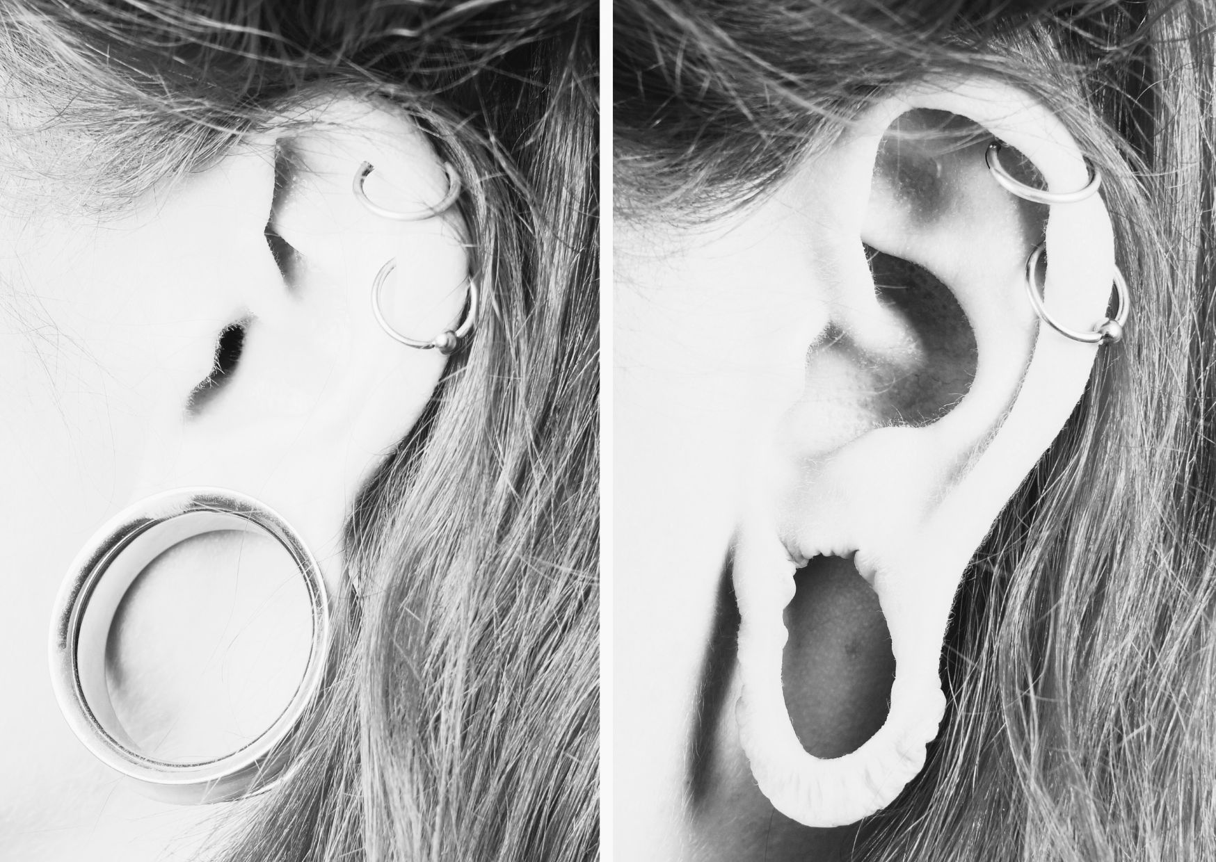 tunely v uších - odstranění tunely v uších - odstranění